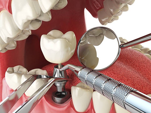 Best Broken or Chipped Tooth Repair in Lakeside, OR